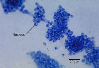 Example of a unicellular fungus
