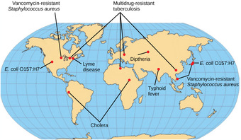 Regions of bacterial disease emergence
