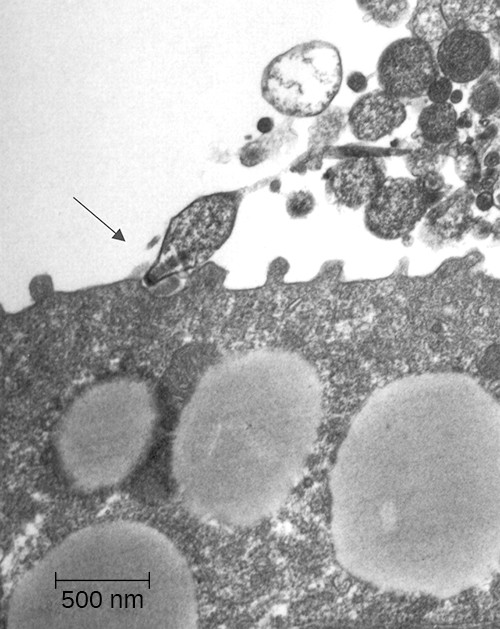 The micrograph shows Mycoplasma pneumoniae using their specialized receptors to attach to epithelial cells in the trachea of an infected hamster.