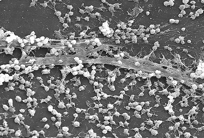 Glycocalyx produced by bacteria in a biofilm allows the cells to adhere to host tissues and to medical devices such as the catheter surface shown here.
