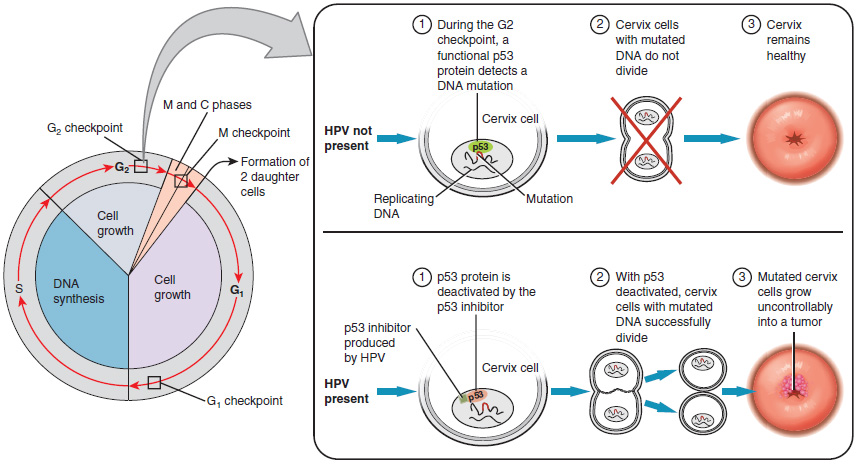 diagram of Development of cervical cancer
