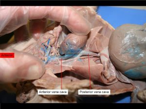 Anterior vena cava, posterior vena cava.