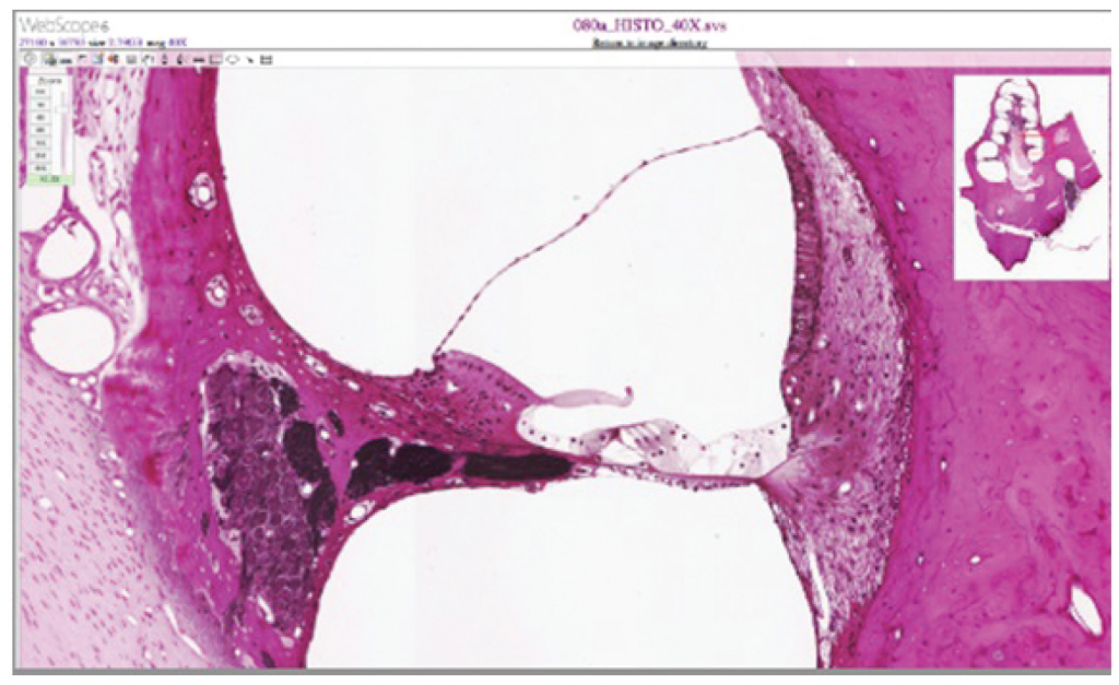 Cochlea and organ of corti.