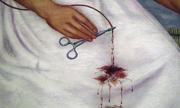 Frida Kahlo, detail with hemostat, The Two Fridas (Las dos Fridas), 1939, oil on canvas, 67-11/16 x 67-11/16″ (Museo de Arte Moderno, Mexico City) (photo: Dave Cooksey, CC: BY-NC-SA 2.0)