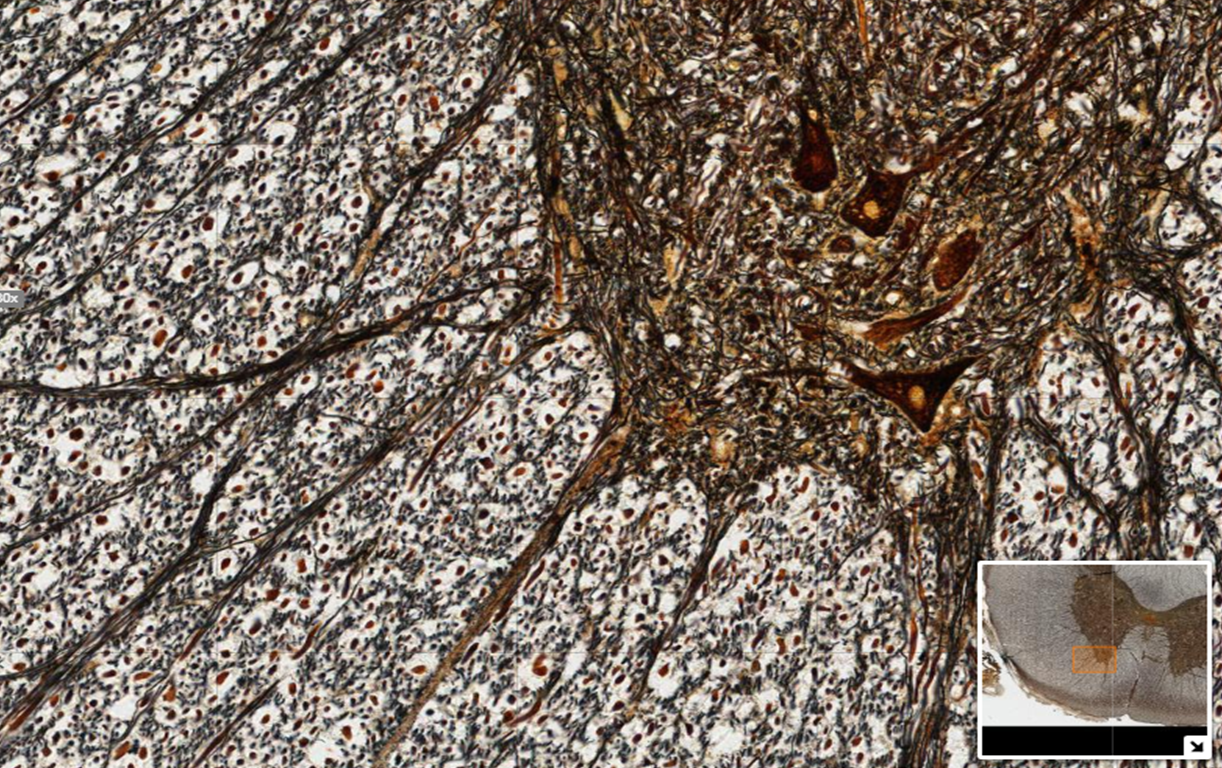 High magnification micrograph of silver stained spinal cord section showing part gray and part white matter