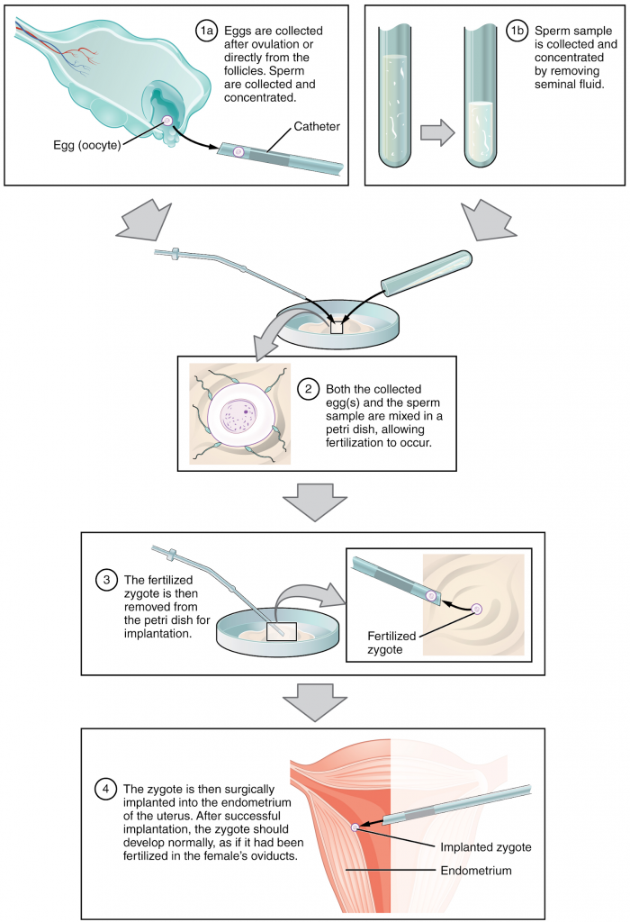 IVF process