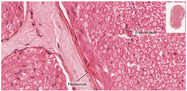Close-up of nerve trunk