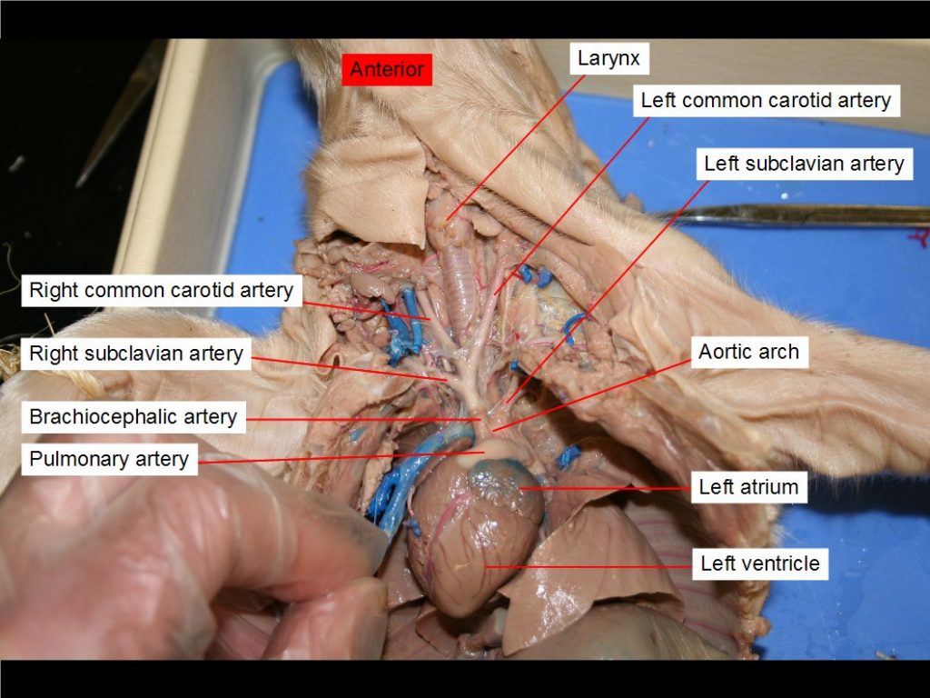 Anterior vena cava, coronary artery, larynx, posterior vena cava, right subclavian vein, trachea.