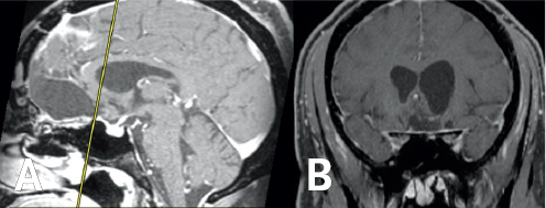 (Left) Light and dark gray variations are enclosed by a large black and white outline. (Right) Light and dark gray variations are enclosed by a large black and dark gray outline.