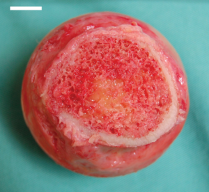 Bone marrow
