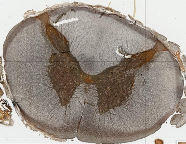 Silver stained section of the spinal cord showing the butterfly shaped gray matter and white matter around it at low magnification