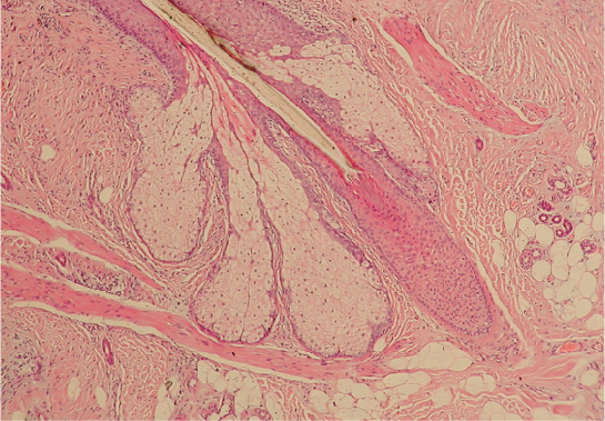 Hair follicle micrograph